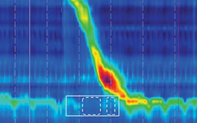 Cómo realizar e interpretar una manometría esofágica de alta resolución